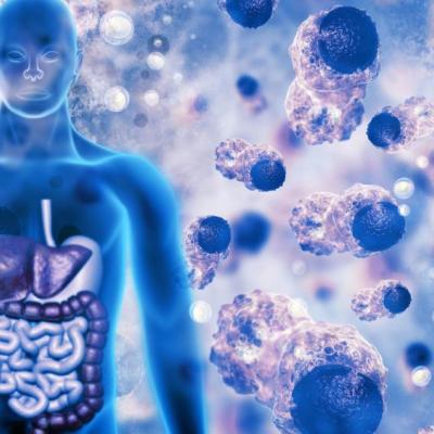 O que é Estresse Oxidativo?